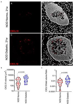 Pancreatic Alpha-Cells Contribute Together With Beta-Cells to CXCL10 Expression in Type 1 Diabetes